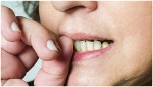 prevention of oral habits that have a harmful lasting effect on the teeth and jaws