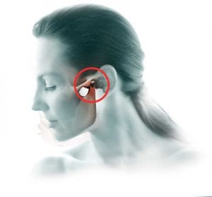 TMJ and TMJ disorders