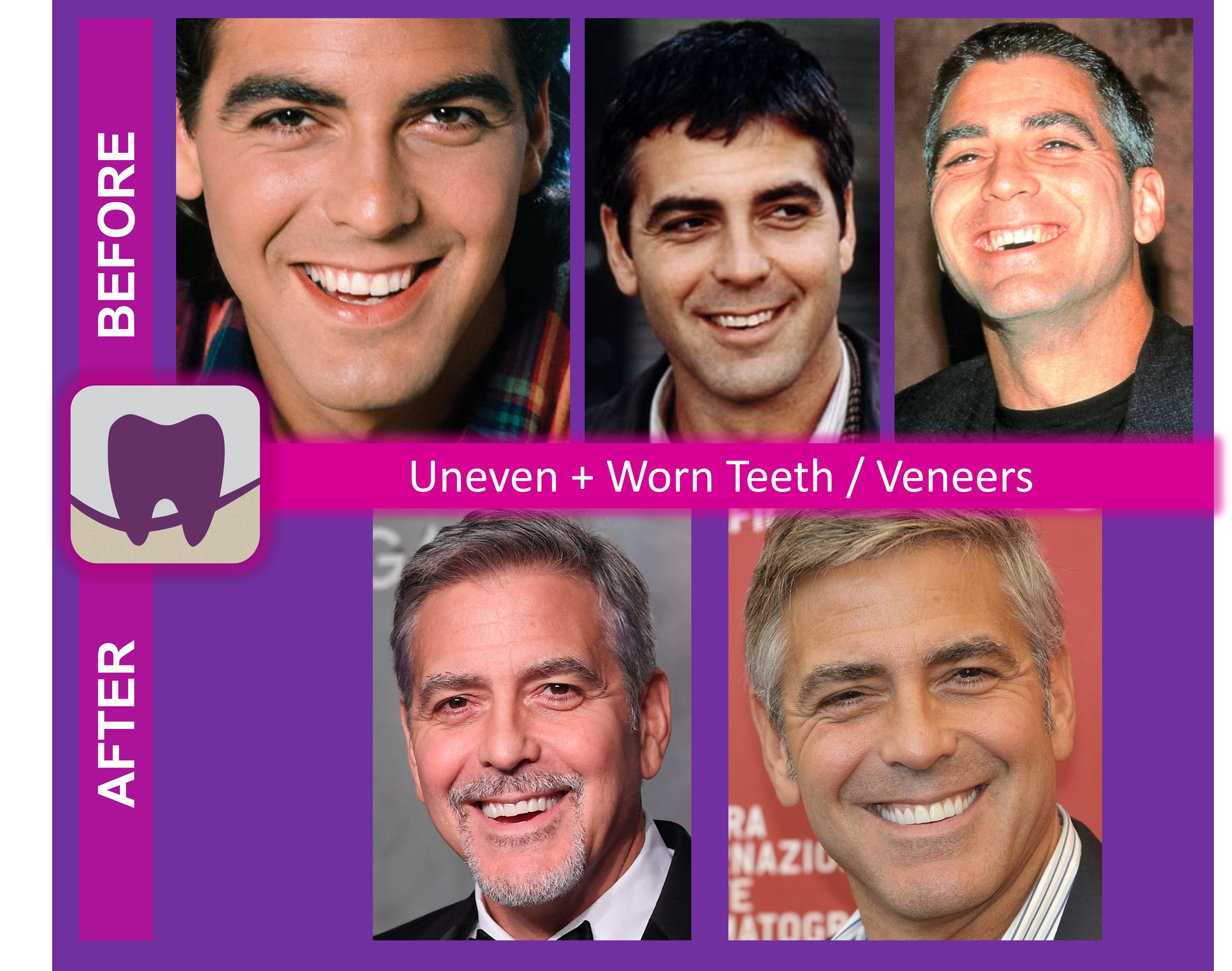 George Clooney Before and After