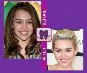 Miley Cyrus Before and After