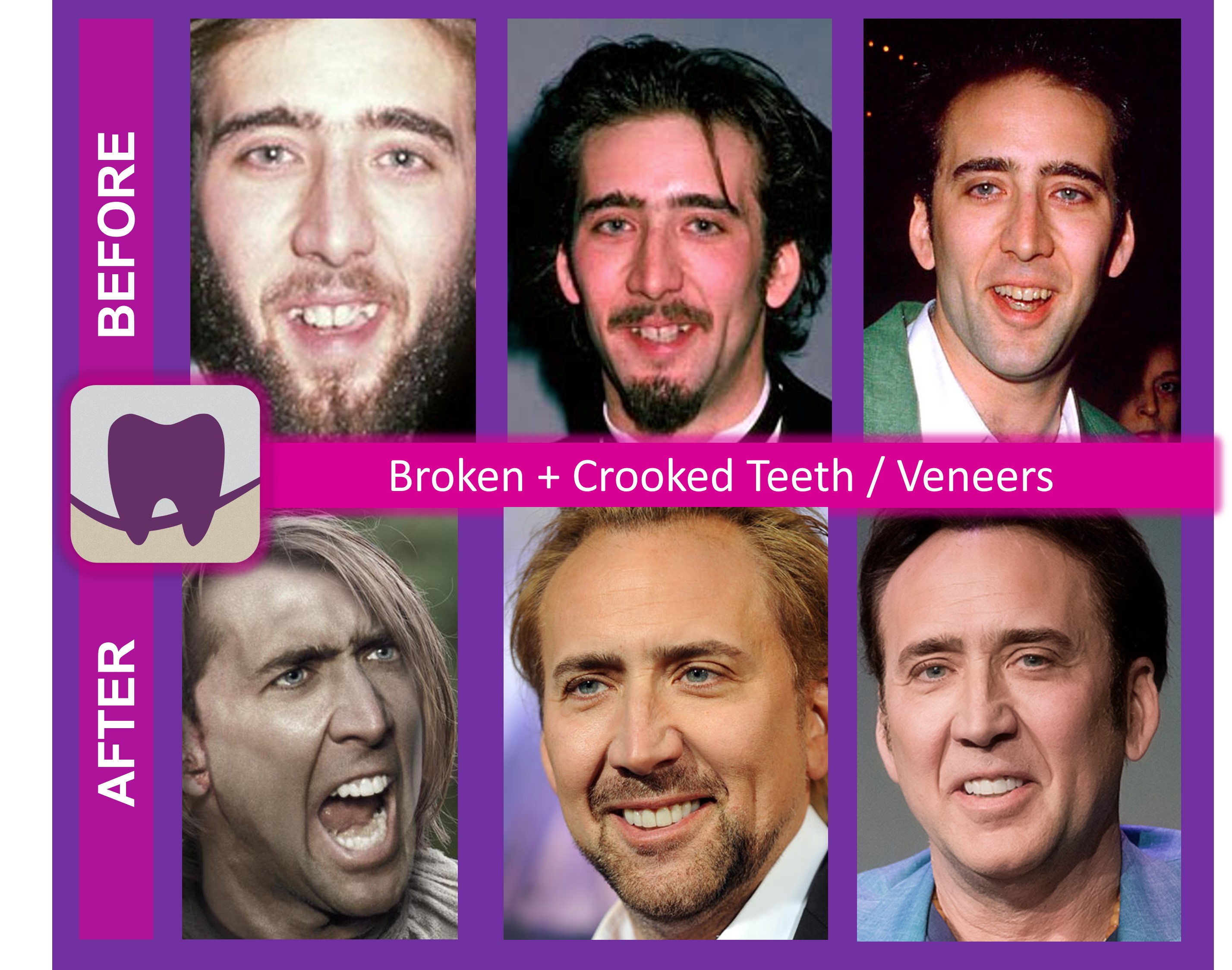 Nicolas Cage Before and After