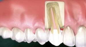 Endodontics